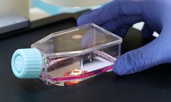 ALS hastalığında genetik temelli yeni tedavi stratejisi üzerinde çalışılıyor