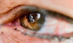 'Fotoğraflı hatırlatma' terapisiyle Alzheimer hastalarının hafızaları tazeleniyor