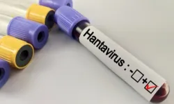 ÖNEMLİ HANTAVİRÜS AÇIKLAMASI