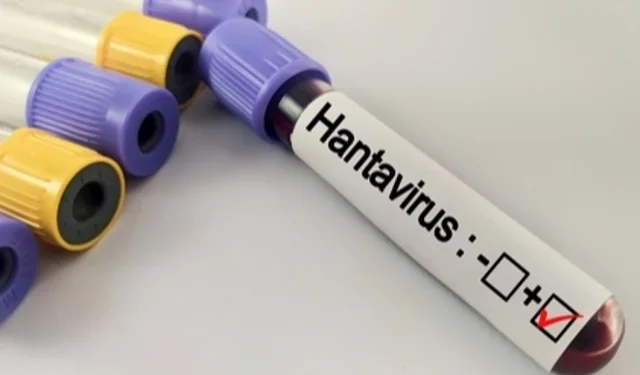 Hantavirüs salgına dönüşür mü? Kapalı alan temizliğinde büyük risk