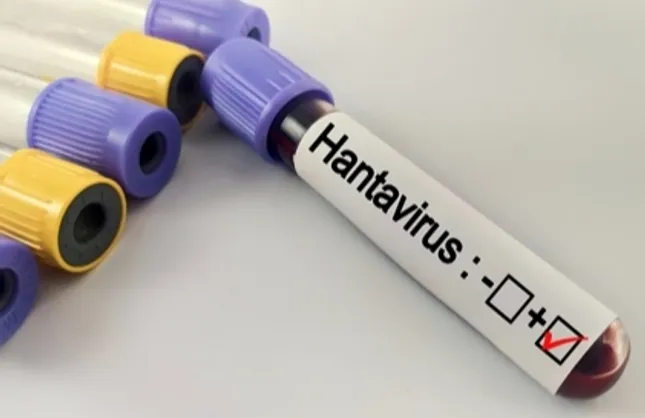 ÖNEMLİ HANTAVİRÜS AÇIKLAMASI